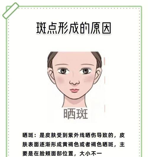 仙人掌黄了怎么补救还有斑点？可能的原因和解决方法是什么？